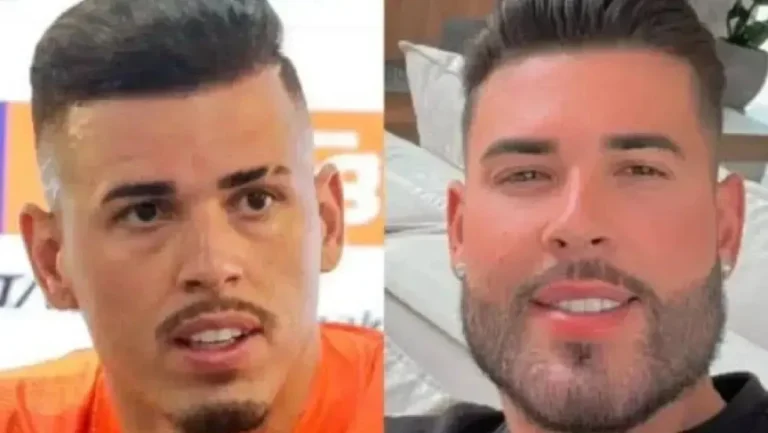 De Vini Jr. a Ivan: relembre jogadores que fizeram harmonização facial